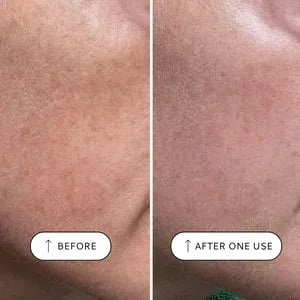 VOTARY Sensitive Resurfacing Peel - 10% Lacid Acid & Super Seeds