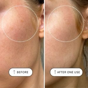 VOTARY Sensitive Resurfacing Peel - 10% Lacid Acid & Super Seeds