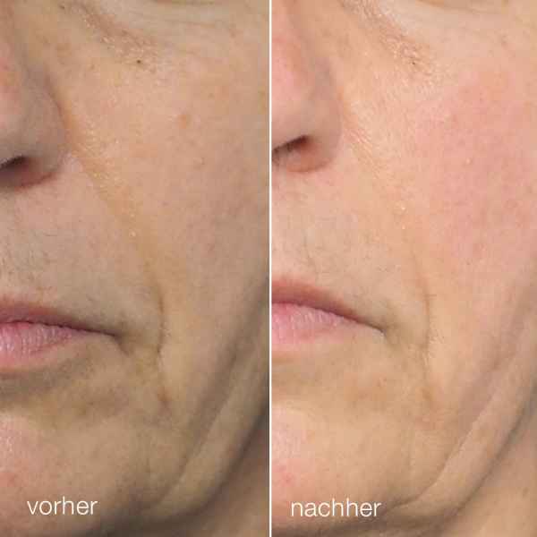 dermalogica Liquid Peelfoliant